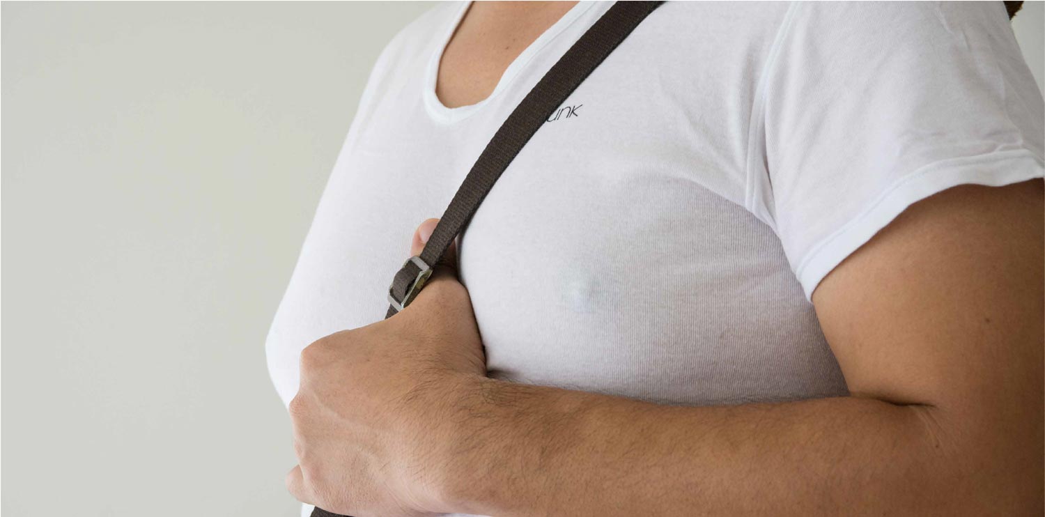 MALE BREAST REDUCTION